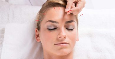 Lifting facial acupuntura elche